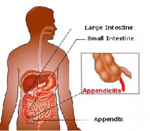 appendix-300x262.jpg