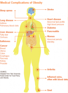 Medical_complications_of_obesity-219x300.png