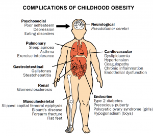 childhood_obesity_complications