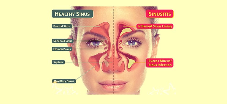 ent-treatment-neoalta-speciality-clinic